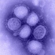 Pandemie de gripă porcină