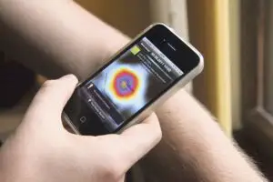 Tehnologie «made in Romania» împotriva cancerului de piele