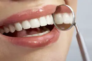 De ce să alegeți cele mai bune coroane si fatete dentare? (P)