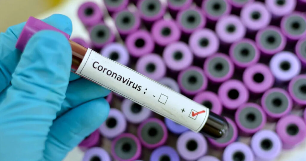Breaking News! A fost confirmat al doilea caz de coronavirus în București
