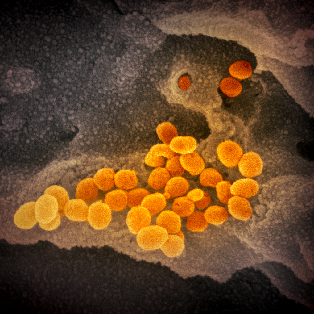 Un nou caz de infectare cu coronavirus! Numărul persoane infectate crește