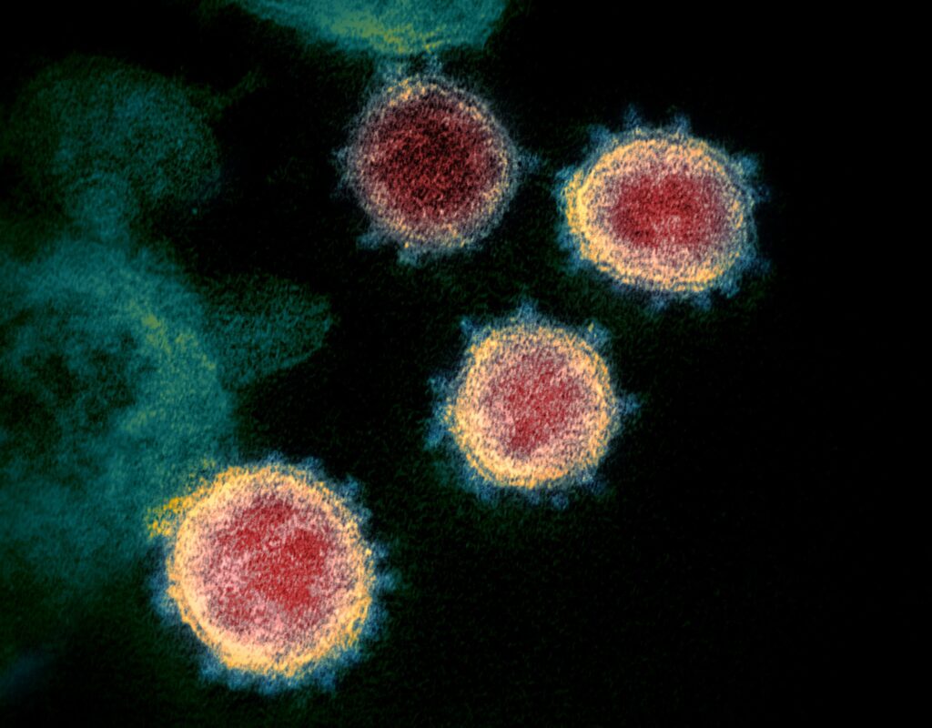 Cum poate evolua coronavirusul! Infecția va fi mai frecventă în următorii ani