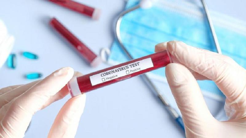 Un nou simptom coronavirus. Medicii francezi trag un semnal de alarmă