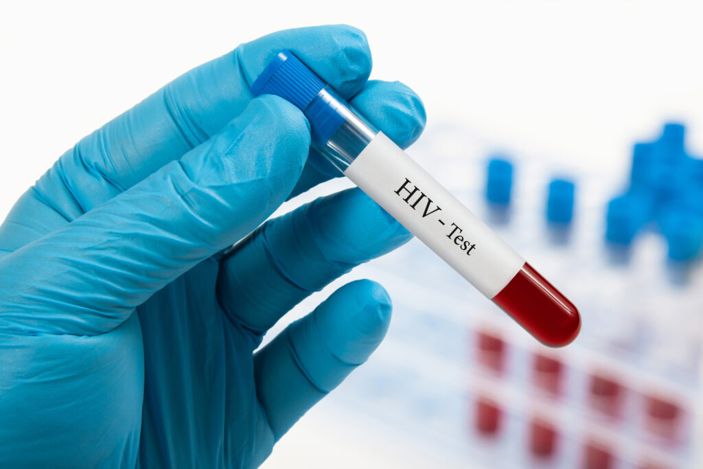 Revoluţie în lumea medicală: vaccinul împotriva HIV/SIDA este deja testat în mai multe ţări