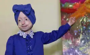 O fetiță de 10 ani a murit de bătrânețe. Suferea de o boală rară