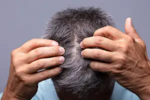 Șapte remedii naturale care combat mătreața. Cum putem scăpa de ea rapid