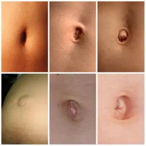 Dacă buricul tău arată așa, trebuie să mergi urgent la medic! Boala gravă pe care o poți avea