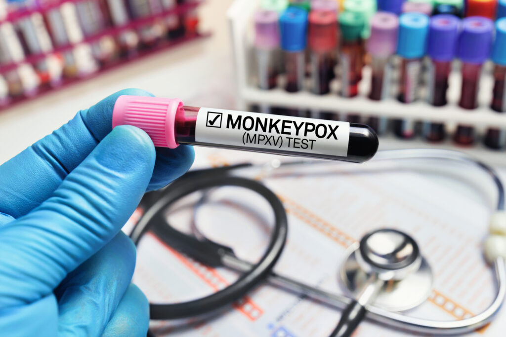 Cum este să ai variola maimuțelor. Pacienții și experții vin cu explicații