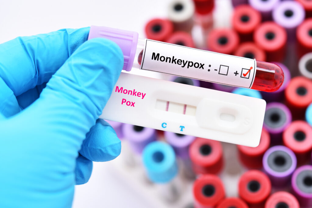 Un nou caz de infectare cu variola maimuței în România. În ce stare se află pacientul