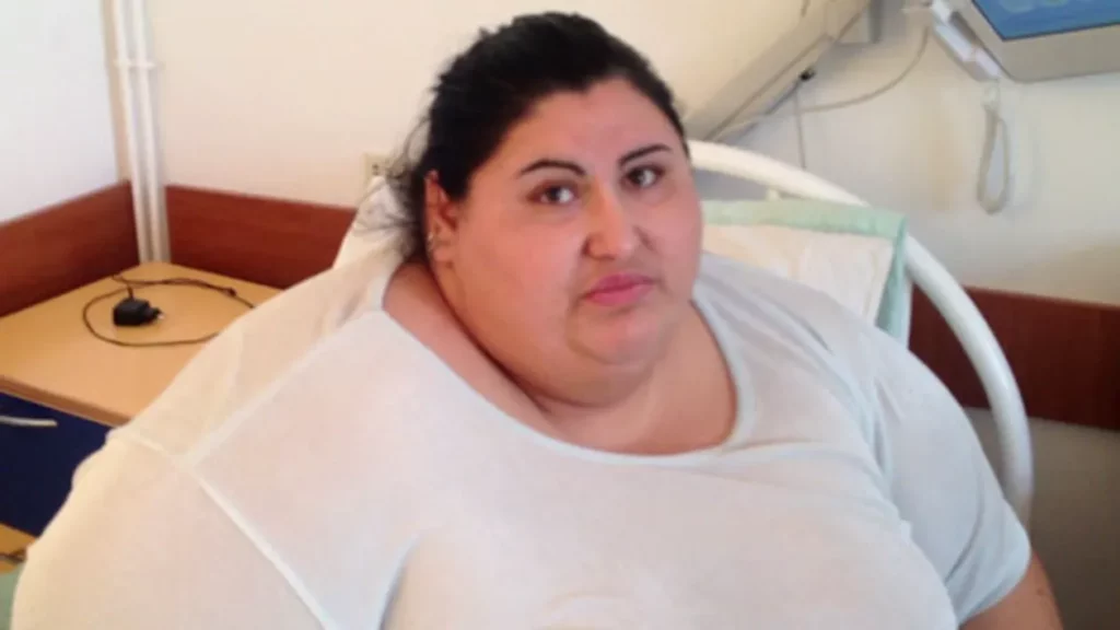 Cea mai grasă femeie din România a slăbit peste 100 de kilograme. Cum arată acum Mariana Buică?