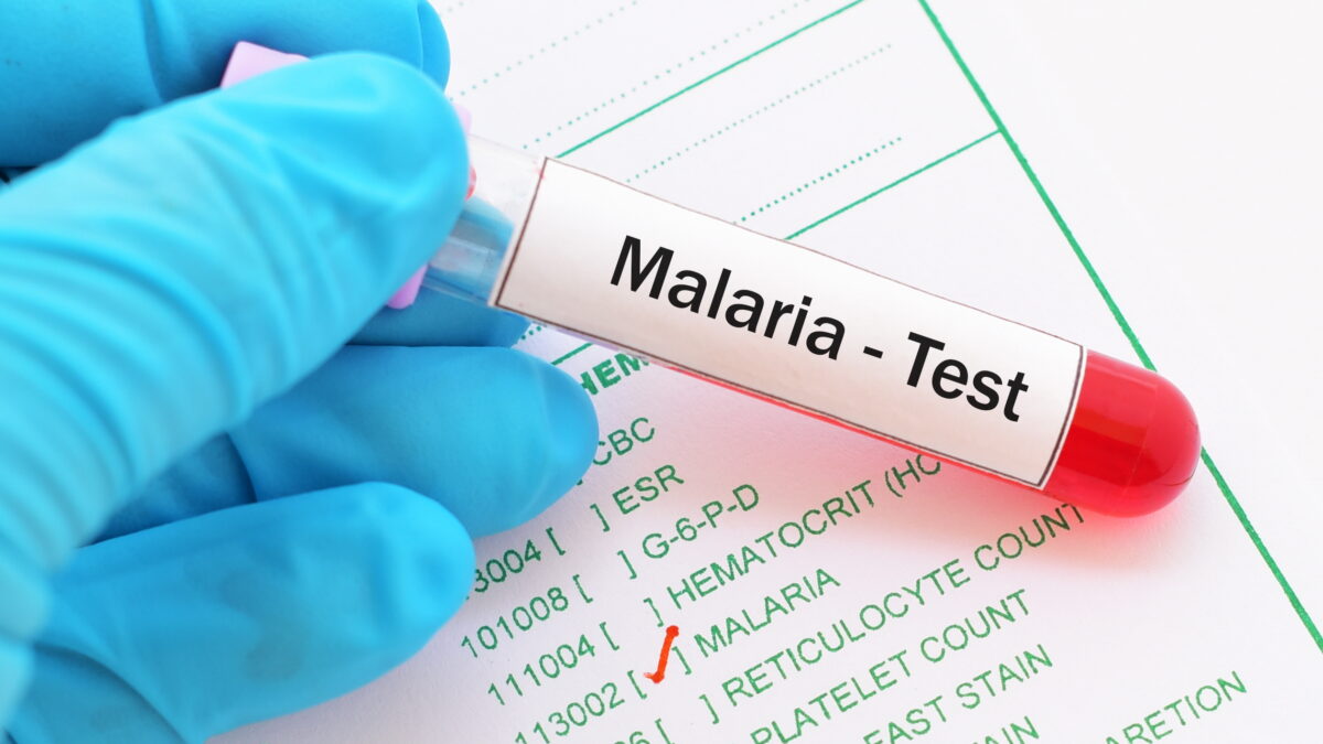 Malarie în România. Alexandru Rafila: Simptomele pot semăna cu cele de gripă