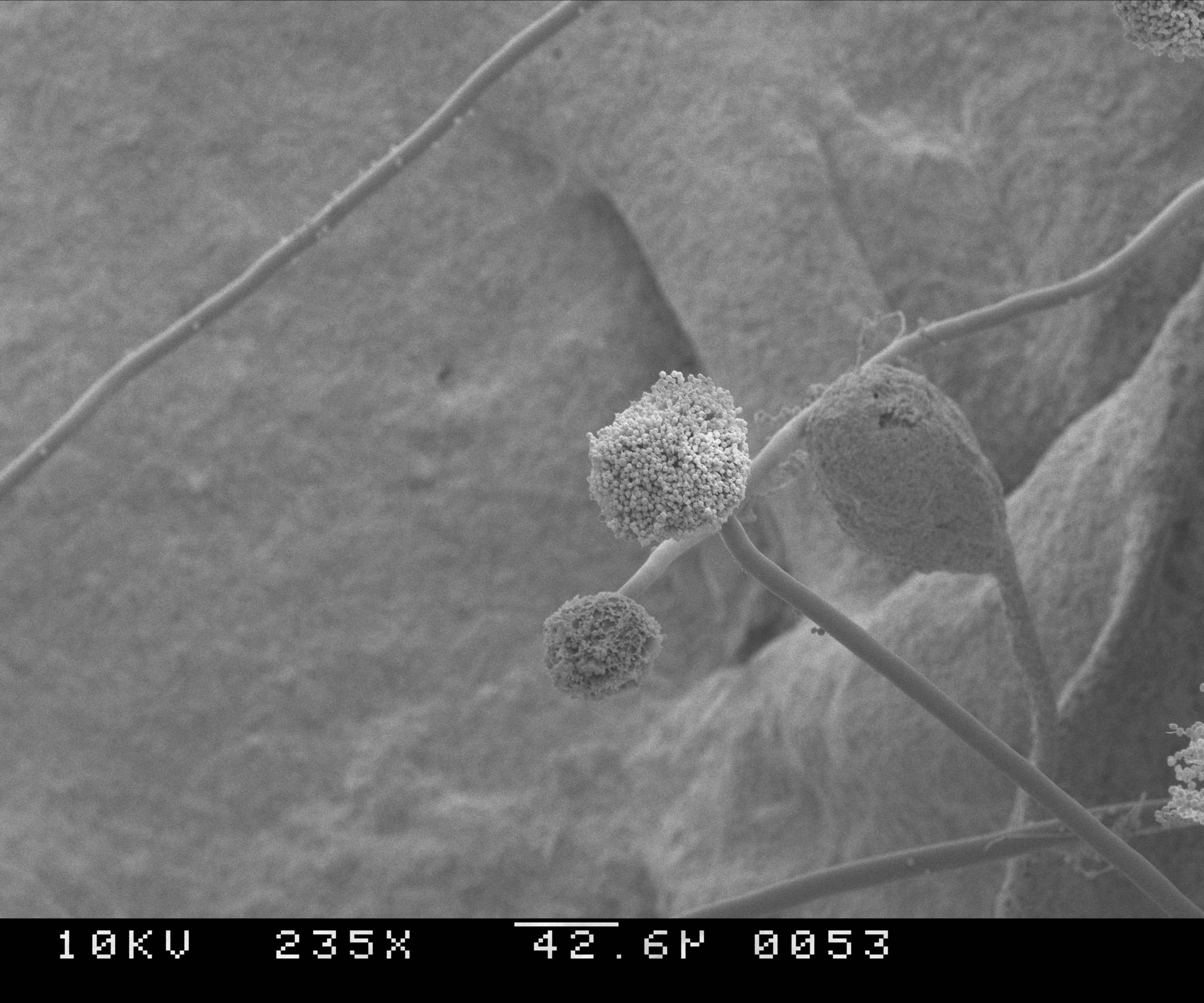Aspergillus