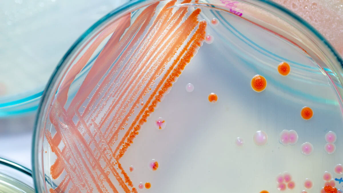 UPDATE. Bacteria Serratia marcescens a ucis 6 copii. Ministrul Sănătății: Cei care nu şi-au făcut treaba vor pleca acasă, fără discuţie. Ce au transmis Ilie Bolojan și Nicușor Dan
