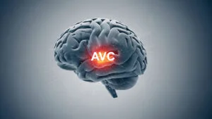 Grupa de sânge și riscul de AVC. Ce rol are propriul organism în prevenirea bolilor cardiovasculare