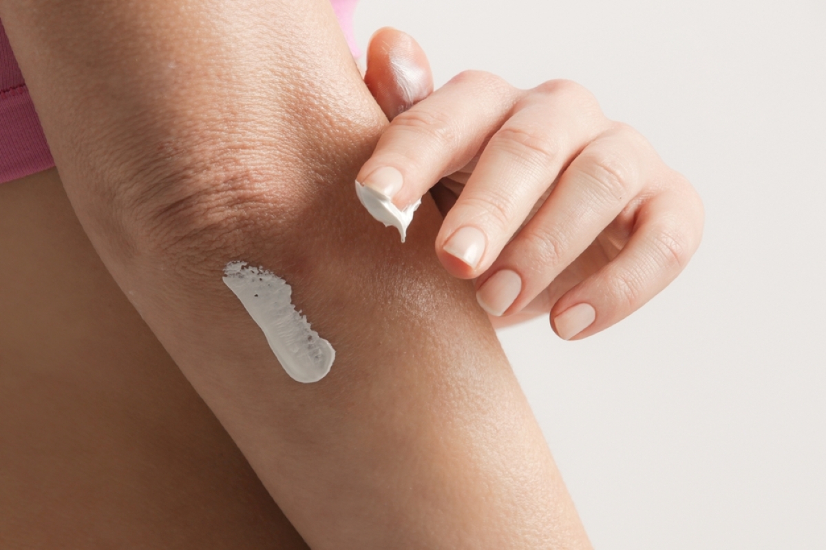 Când și cum să folosești crema cu uree pentru rezultate optime