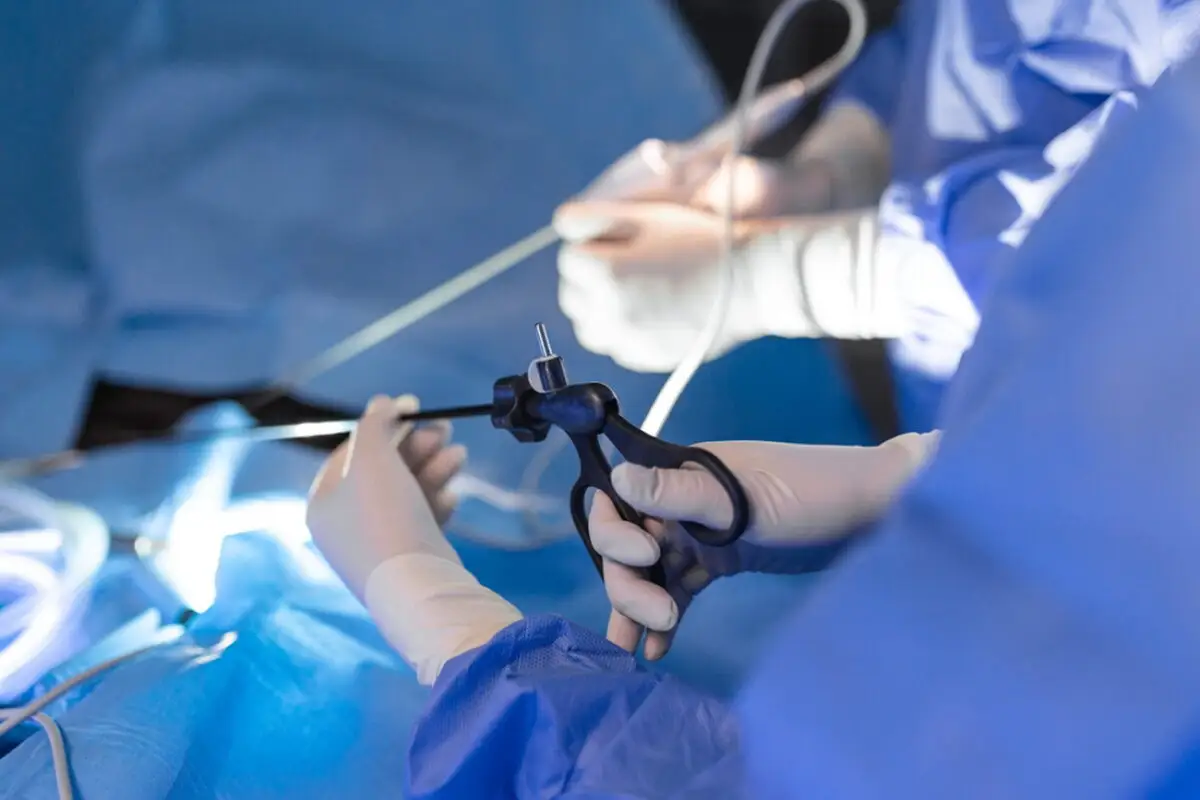 5 beneficii ale chirurgiei urologice minim invazive