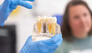 De la extracție la implant dentar: pașii corecți pentru o vindecare corectă