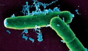 ANSVSA cere intensificarea controalelor la graniţa cu Serbia, în urma epidemiei de antrax