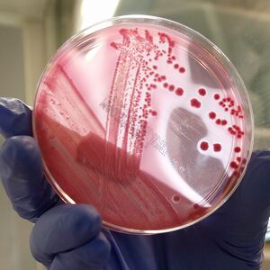 Bacteria Eceh: primul caz confirmat în Polonia